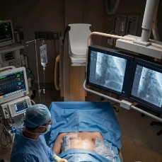 Cardiac Catheters