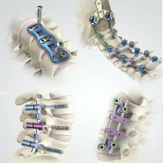 Spinal Implants